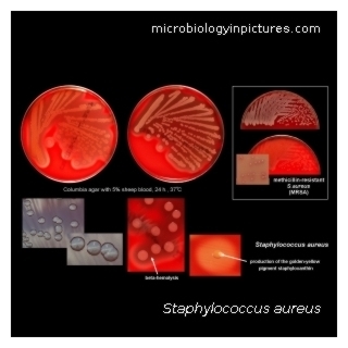 s.aureus